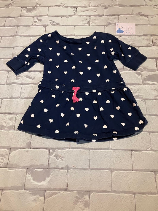 Top Size 2-3